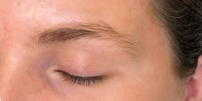 Before: a light, flat brow above a closed eye.