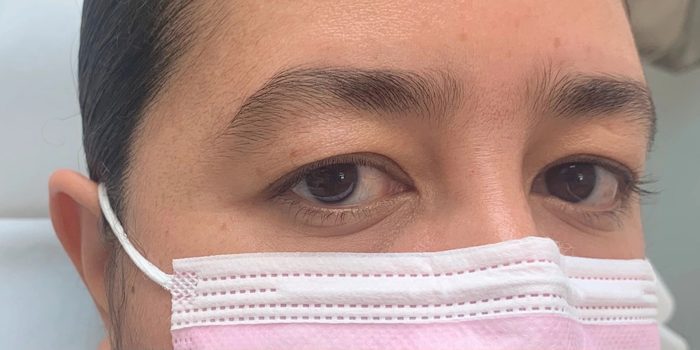 Before: sparse, uneven brows.